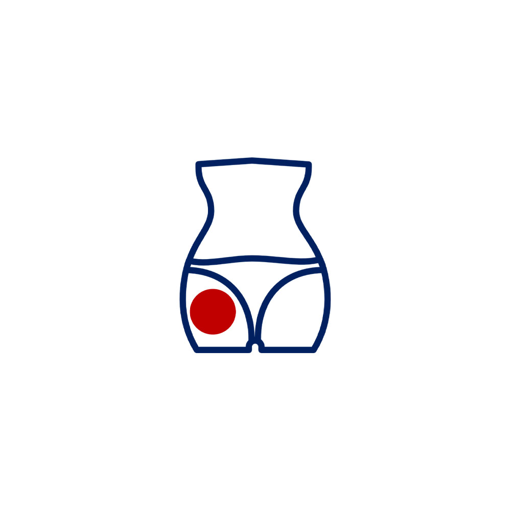 Estrías (prevención)